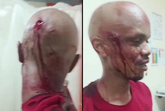 Another victim of the clashes between gangs in Nigeria 