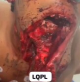 BRUTAL: Idiot has Face Removed by Bull 