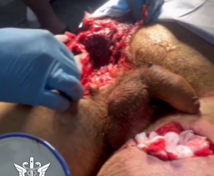 Russian wounded soldier hospitalized 