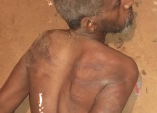 [PART2]Ethiopian old man kidnapped and tortured by Libyan militia 