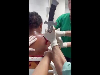 Brazilian man was stabbed with a sword