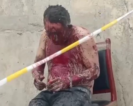 Another victim of the explosion happened today in Chinese factory 