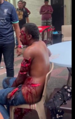 Hoorrible machete attack 