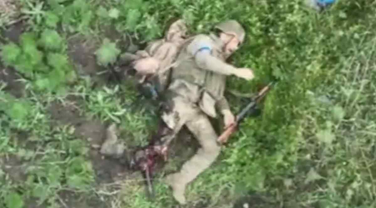 Limb amputation, slow and painful death. 