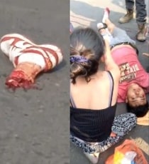 Biker Lost His Leg After Brutal Accident