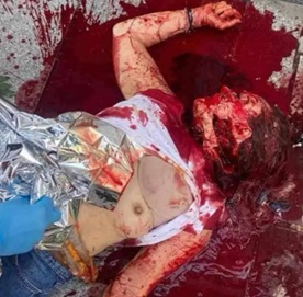 Axe-Wielding Attacker Kills a Woman at Warsaw University