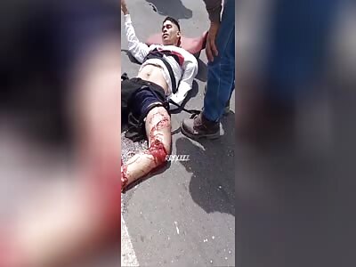 Two motorcyclists suffer serious after-effects, one survives 