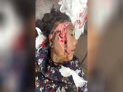 SHOCKING: Woman victim of accident 