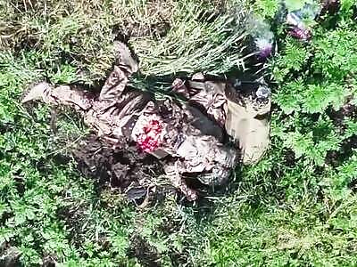 An anatomy lesson from Russian illegal immigrants.