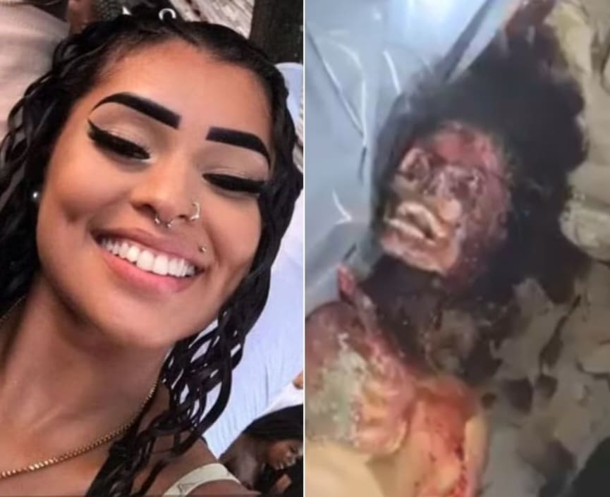 Body Of Murdered Teen Found Mutilated By Pitbulls