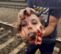 Workers took a Pic with Girls Head after Suicide