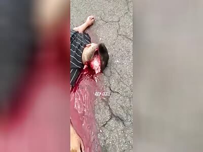 Victim ends up with his skull shattered in a motorcycle accident 