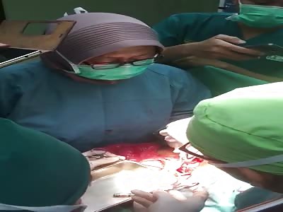 4 years girl, while operation à¤ªà¥‡à¤Ÿ à¤¸à¥‡ à¤¨à¤¿à¤•à¤²à¥€ à¤µà¤¸à¥à¤¤à¥à¤ à¤¦à¥‡à¤–à¥‡à¤‚à¤—à¥‡à¥¤ à¤”à¤° à¤›à¥‹à¤Ÿà¥‡ à¤¬à¤šà¥à¤šà¥‹à¤‚ à¤•à¥‡ à¤®à¤¾à¤¤à¤¾ à¤ªà¤¿à¤¤à¤¾ à¤‡à¤¸