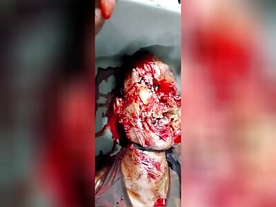 Victim with his face smashed with a machete 