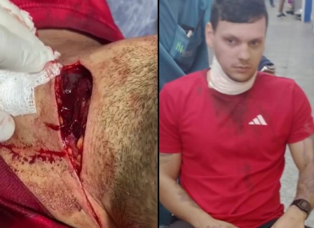 Young man nearly slaughtered during fight 