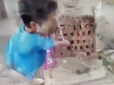 hard working kid with a deformity