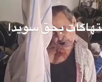 Civilians killed by the druzes during clashes with the HTS