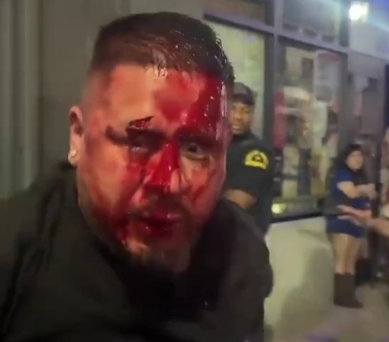 Man on black t-shirt was attacked by Mexican outside nightclub 