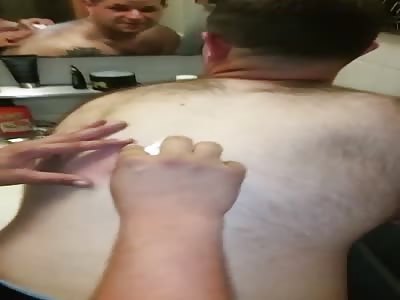 When Popping Your Friend's Zit Goes Horribly Wrong