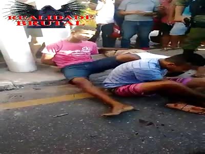 man agonizes after his broken leg open fracture  