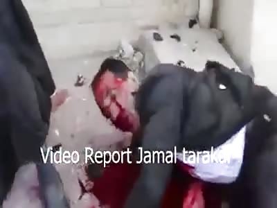 Aftermath - Quetta explosion 