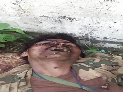 rotten body of houthi soldier 