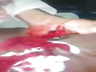 Horrible Motor Bike Accident in Gilgit