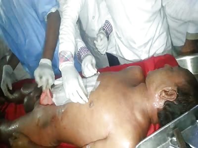 WTF Medical School:  student with hijab love the big ball of indian deadbody