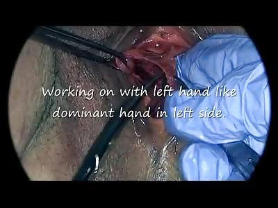 Female Genital  Medical Examination Of Dead Women