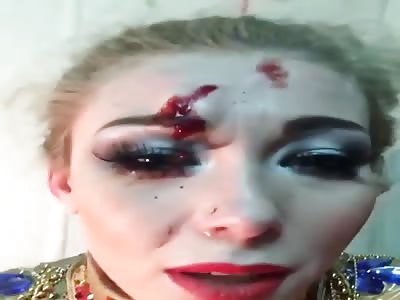 Circus Animal Trainer Hurt In Fall From Camel