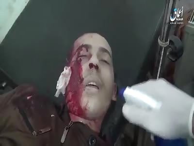 ALEPPO - VICTIMS OF TURKISH BOMBING AT THE CITY GATE