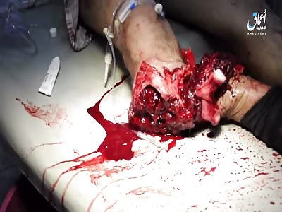 shocking result of a mortar attack by Iraqi forces on the area of white door t