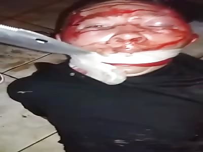 the face of gang mumber after hard torturing