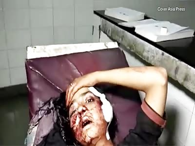 Girl shot by brother and father in 'honour killing' attempt