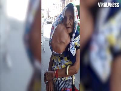 Woman With Large Tumor Needs Treatment