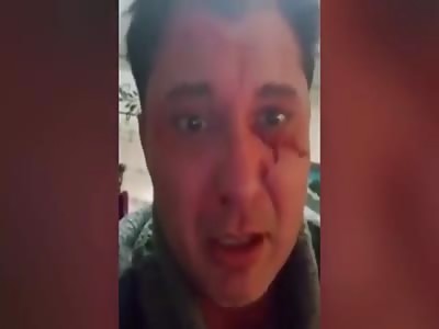  terrified man films abusive girlfriend's vicious knife attack