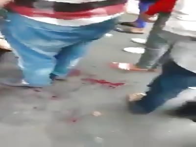 Woman Stabbed In The Back ...