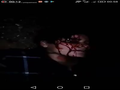 tunisian woman shoot in the head by brother