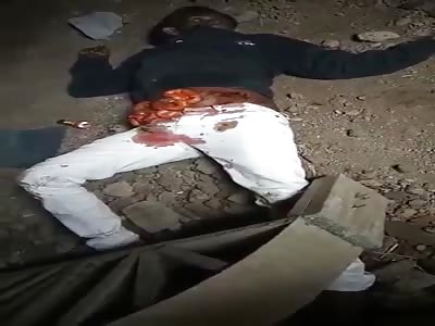 open belly and guts out after he get shoot by army