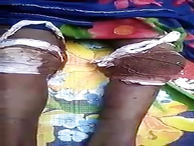 rohingya kid killed by Chinese communist army