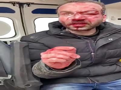 This is what you got for not respecting quarantine in Russia 