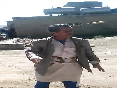 WTF: Big Knife Stuck in Man's Skull