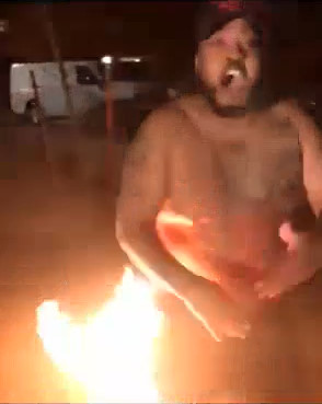 Stupid Dumb Asshole Burns Himself 