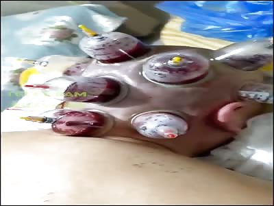 New Chinese medical treatment 