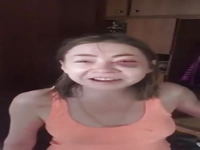 The result of living with abusive boyfriend 