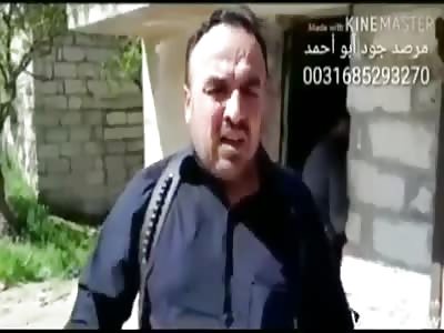 Old homeless Syrian have rotten foot full of warm