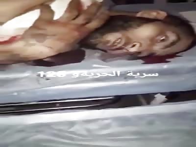 Syrian terrorist captured Cursing Erdogan moments before his death