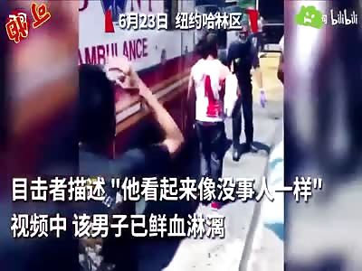 Bloody man with knive stuck in his forehead 