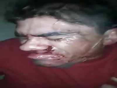 Thief with bloody face