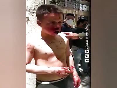 Thief brutally beaten.